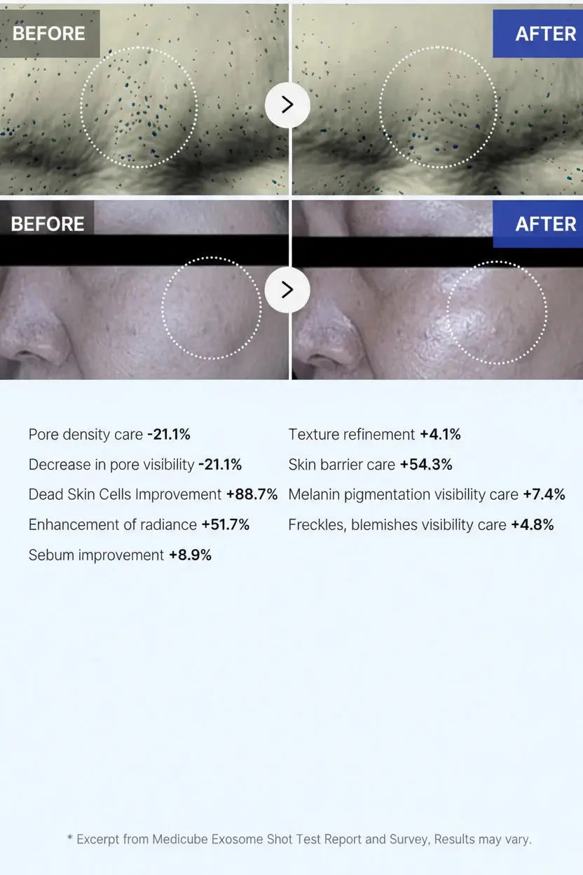 Medicube Zero Exosome Shot - Skin-Renewing Ampoule Honos Beauty
