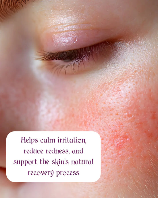 Hygia's Blue Hypochlorous Acid Spray - Fragrance-Free,  Sensitive Skin, Calm Refresh and Protect Honos Beauty