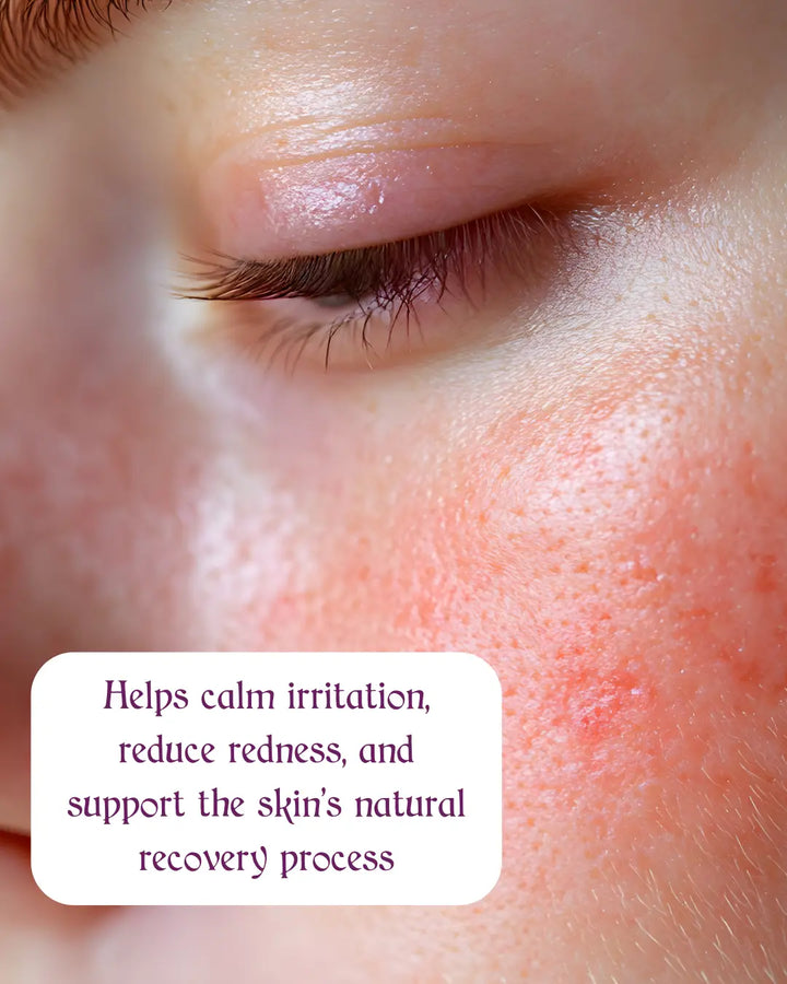 Hygia's Blue Hypochlorous Acid Spray - Fragrance-Free,  Sensitive Skin, Calm Refresh and Protect Honos Beauty