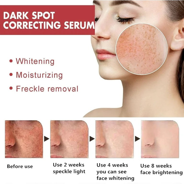 Hoygi Dark Spot Correcting Serum