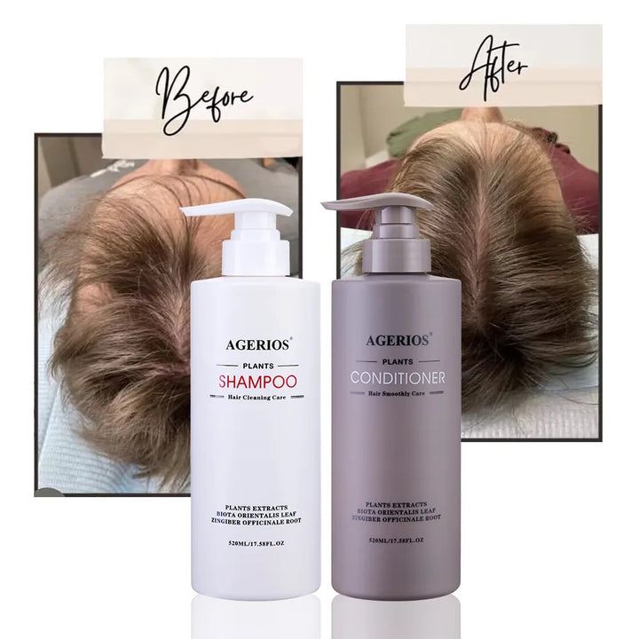 Agerios Hair Growth Conditioner