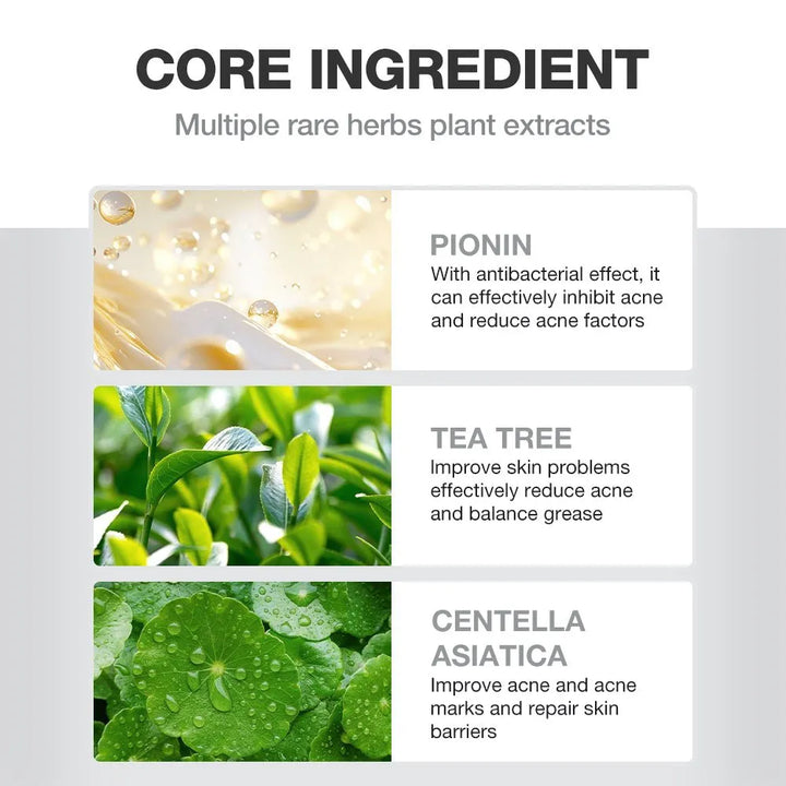 Salicylic Acid Acne Treatment Ice Sleep Masque