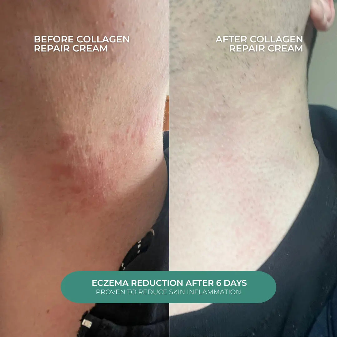 Human Collagen Recombinant Sheet Mask  - Skin feels tighter and wrinkles soften