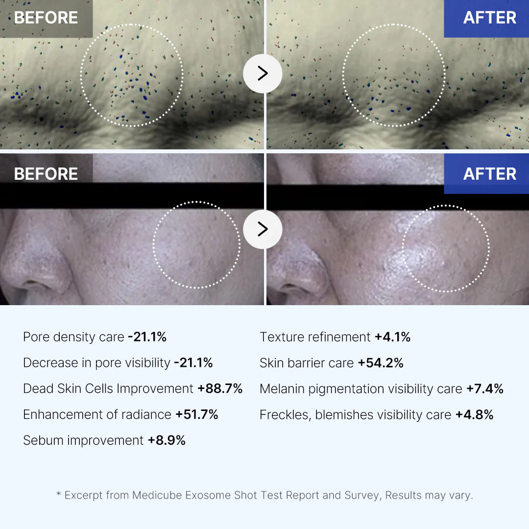 Medicube Zero Exosome Shot - Skin-renewing ampoule