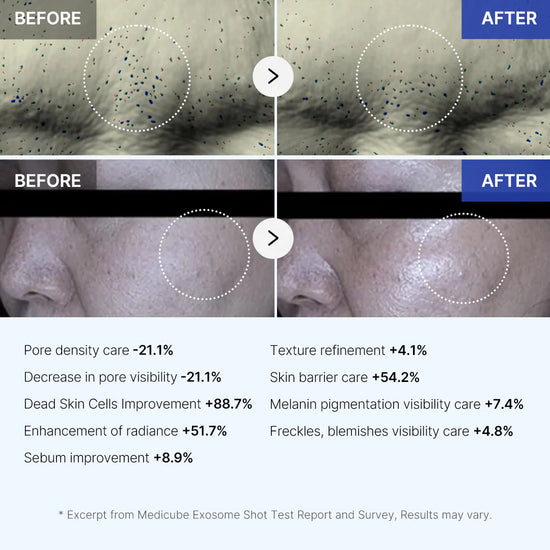 Medicube Zero Exosome Shot - Skin-renewing ampoule