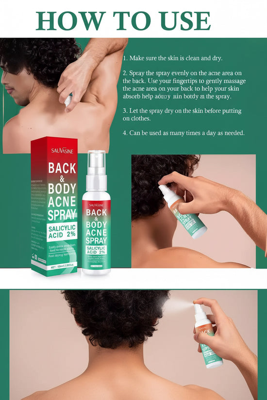 Body Acne Spray - 2% Salicylic Acid - Prevents Breakouts