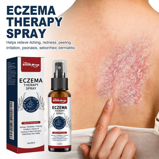 South Moon | Eczema Therapy Spray | Non-steroidal Formula Helps Calm Redness and Irritation